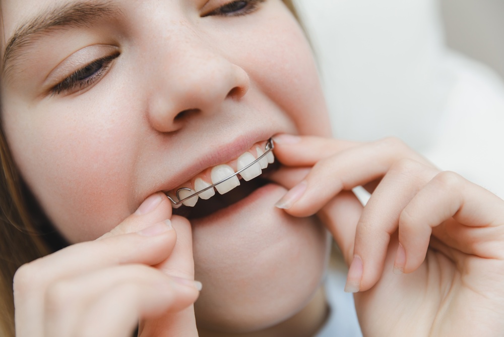 Close up of teenage girl hands adjusting pink removable orthodontic plate on her teeth, daily dental care and bite correction treatment process