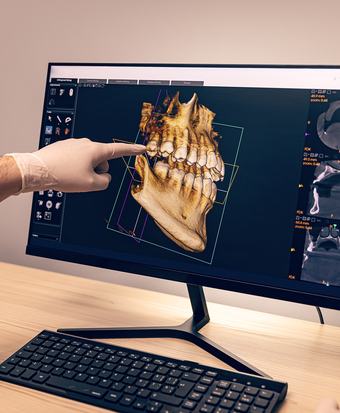 Dentist reviewing a 3D digital scan for dental implant planning at Bagoff Dental Arts in West Orange, NJ